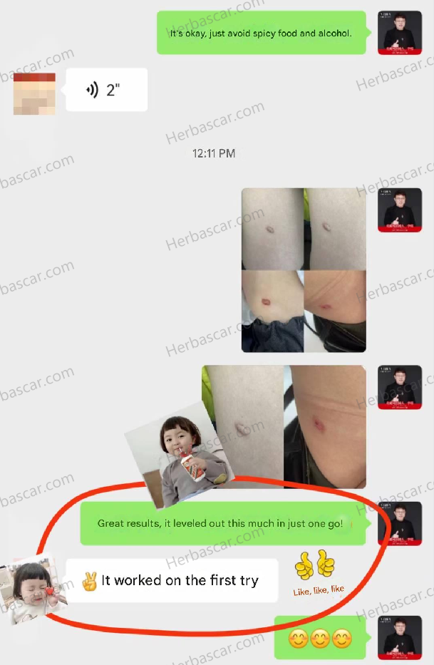 Real Patient Feedback After Using Herba Scar Removal Solution