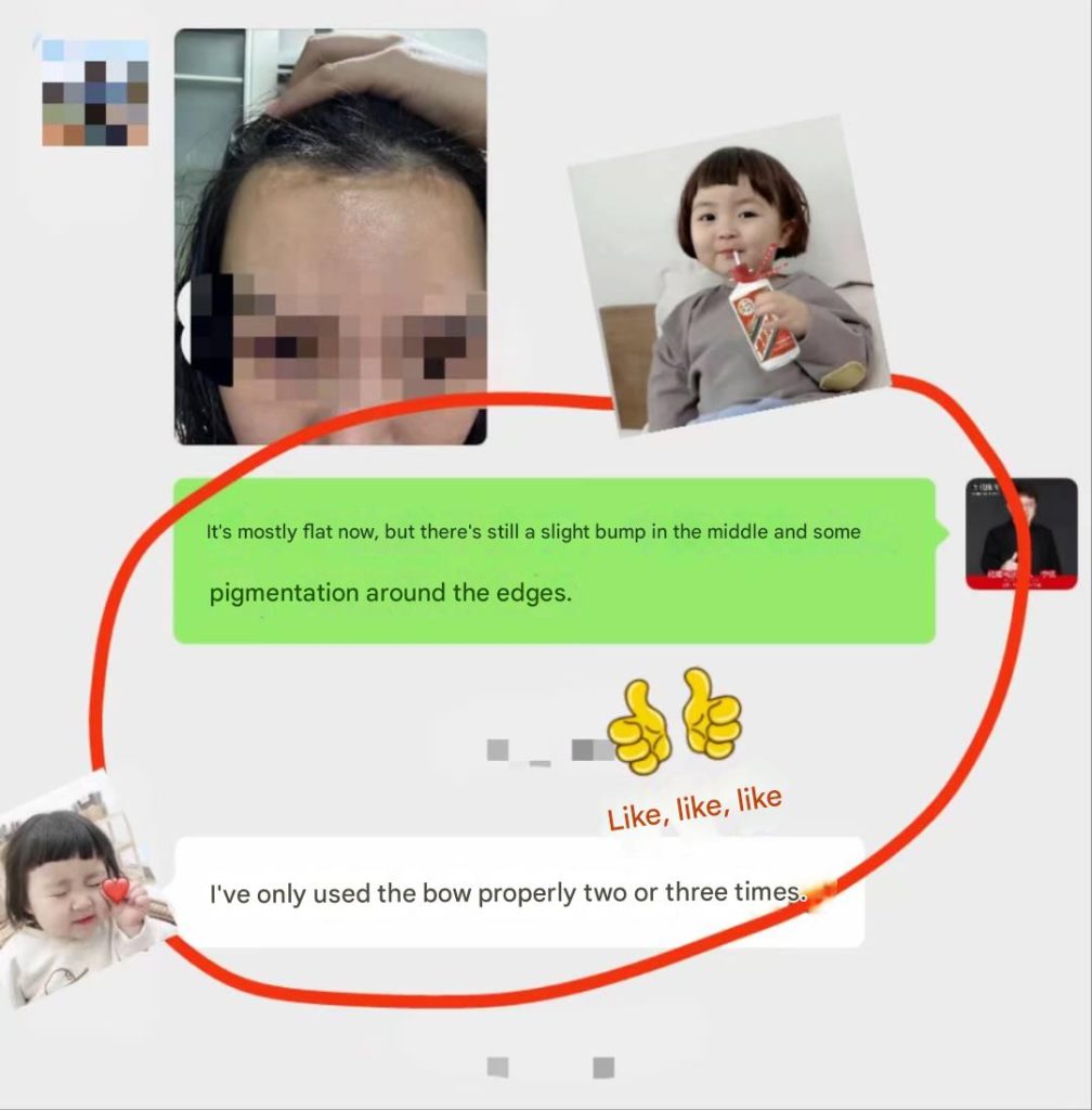 Patient feedback after using Herba scar-removal solution on scalp scars.